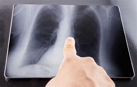 Digital X-Rays Vs Traditional X-Rays: The Differences - Medical Imaging ...