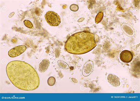 Parasites In Stool Microscope