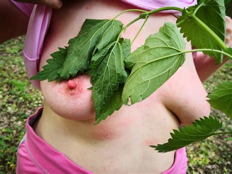 Brennnesseln On Tits 20 Pics XHamster