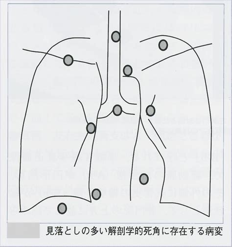 X線診断の基礎知識 レントゲン写真の読み方・簡単解説