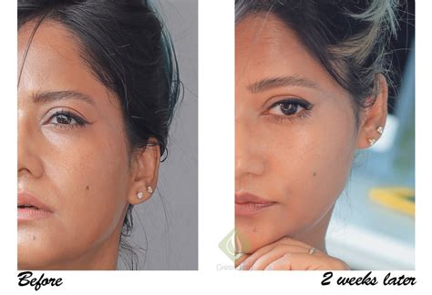 Murad Rapid Dark Spot Correcting Serum And City Skin Age Defense Spf 50