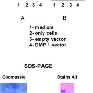 The 4-12% SDS-PAGE gels were loaded with preheated samples plus sample ...