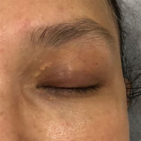 Weird Skin Growths