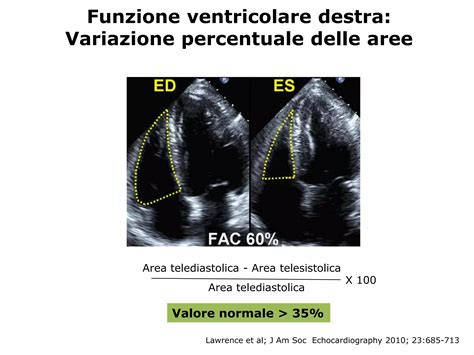 Sistema Ventricolare Sovratentoriale Di Dimensioni Aumentate 5