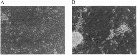 Phase Contrast Micrographs Of Undifferentiated Nt2 A And