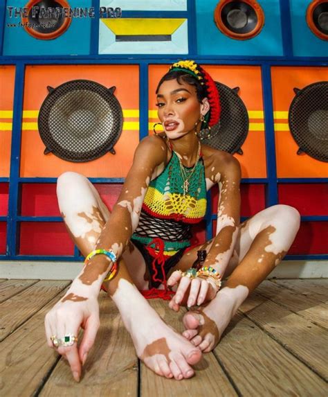 Winnie Harlow Nude The Fappening