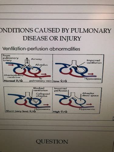 Pathophysiology Pulmonary Alterations Flashcards Quizlet