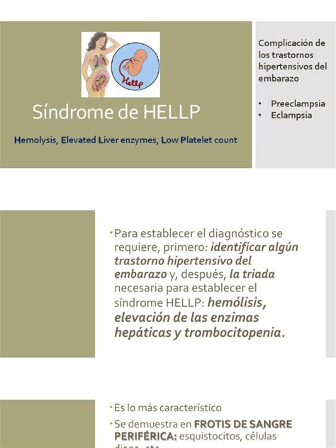 Diagnóstico y Tratamiento del Síndrome HELLP | PDF | Enfermedades y ...