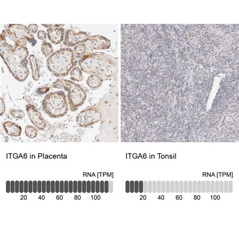 Rabbit Polyclonal Anti-ITGA6 Antibody - Buy for research - Highly ...