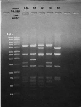 Biol Lab Dna Fingerprinting Ii Electrophoresis And Analysis Of