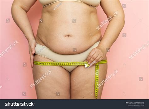 Cropped Photo Naked Overweight Woman Body Stock Photo Shutterstock