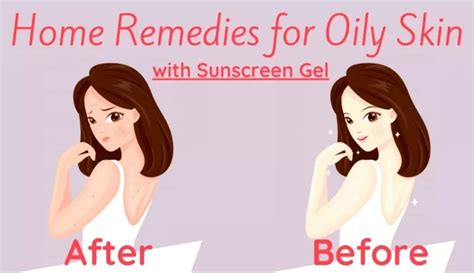 Ppt Home Remedies For Oily Skin With Best Sunscreen Gel Powerpoint