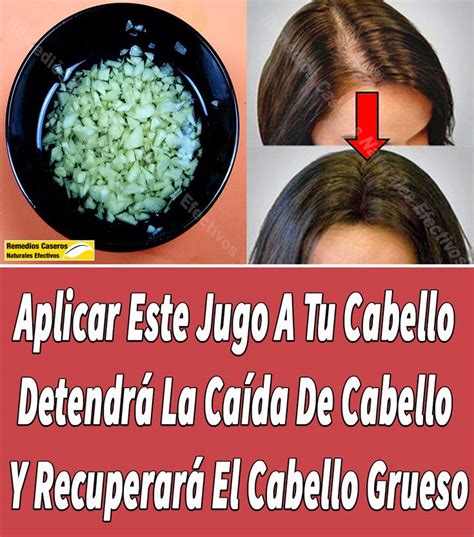 Arriba 95 Foto Remedios Caseros Para La Caída Del Cabello En Mujeres