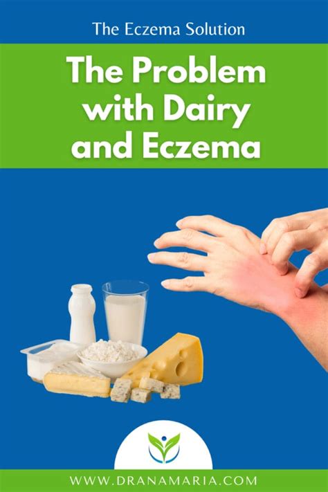 The Problem with Eczema and Dairy - Dr. Ana-Maria Temple