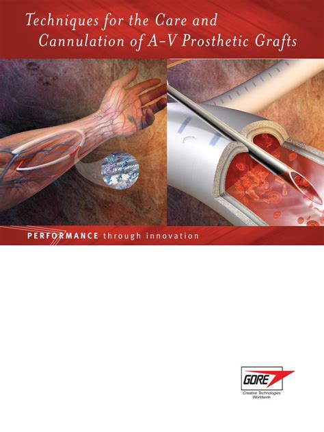 Pdf Techniques For The Care And Cannulation Of A V Prosthetic