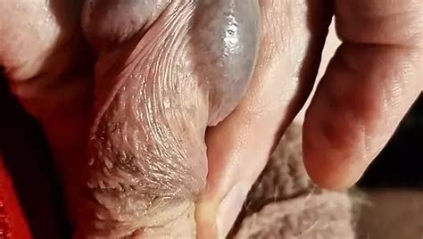 Smooth To Hairy Balls Part 1 Days 1 To 6 Gay In Welsh Porn Feat