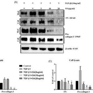 Effects of OA on TGFβ1induced phosphorylation of SMAD2 and SMAD3 p