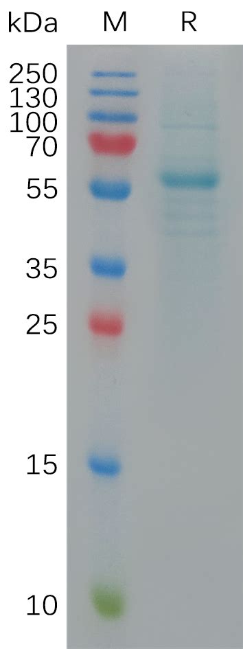 SARS CoV 2 Omicron BA 5 S protein RBD hFc Tag 专注肿瘤免疫