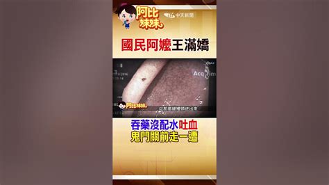 Shorts 國民阿嬤 王滿嬌連續吐血1星期發病危 竟是 吃藥沒配水 導致 阿比妹妹 台灣大搜索cticsi 中天電視ctitv Youtube