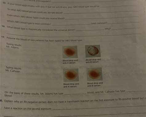 Solved If Your Blood Agplutinates With Anti A But Not Anti B Chegg