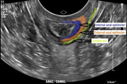 Internal Anal Sphincter