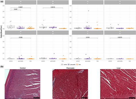 Evidence Of Sex Differences In Cancerrelated Cardiac Complications In Mouse Models Of