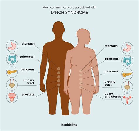 Lynch Syndrome And Ovarian Cancer What S The Risk