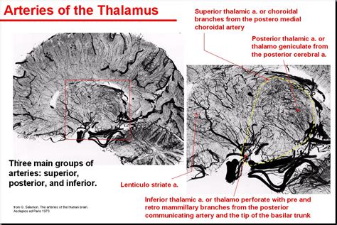 Salamon S Neuroanatomy And Neurovasculature Web Atlas Resource