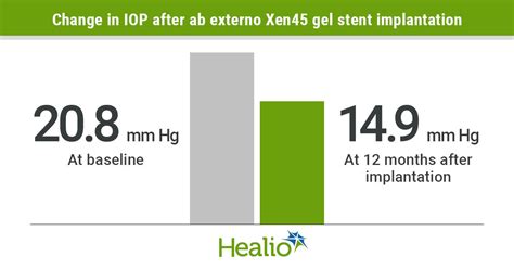 Ab Externo Placement Of Gel Stent Lowers IOP