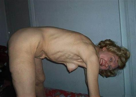 Extremely Skinny Granny Posing Porn Pictures Xxx Photos Sex Images Pictoa