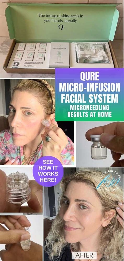 Micro Infusion At Home A Convenient And Effective Treatment Option In