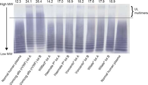 Multimer Composition Of Vwf Concentrates Low Resolution 1 Agarose Download Scientific