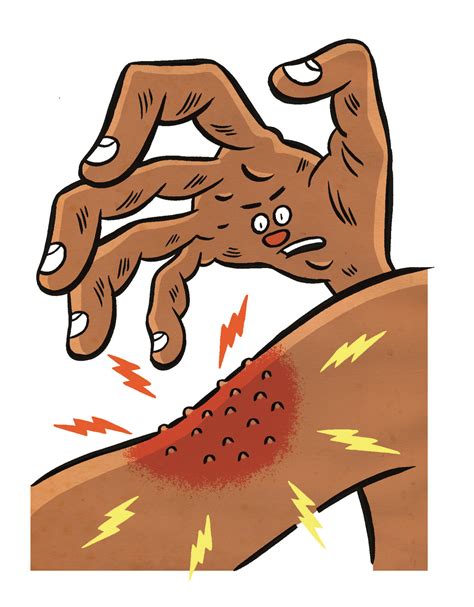 Scratching the Surface