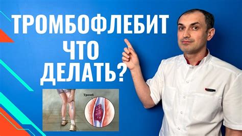 Тромбофлебит: симптомы, лечение, профилактика