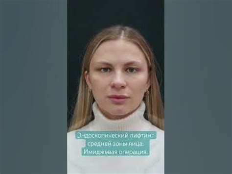 Устранили следы усталости на лице, избавились от мешков. Через 1,5 ...