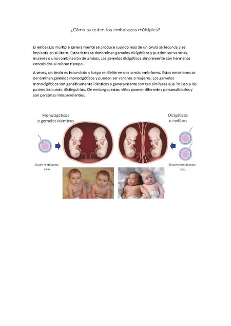Embarazos Multiples ¿cómo Suceden Los Embarazos Múltiples El