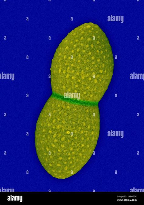 Coloured Scanning Electron Micrograph SEM Of Vancomycin Resistant