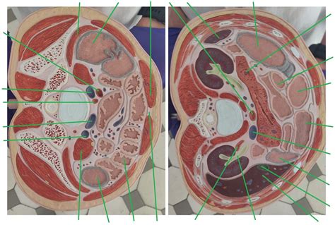 transverse section model diagram quizlet