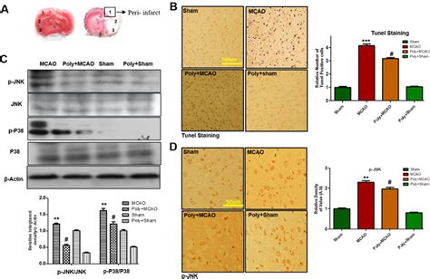 Frontiers Polydatin Attenuates Neuronal Loss Via Reducing