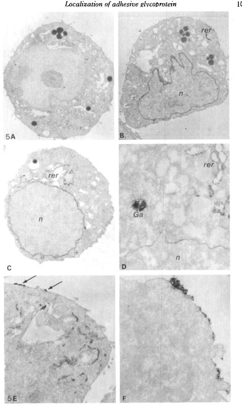 Figure 5 From An Immunoelectron Microscopic Study On The Distribution