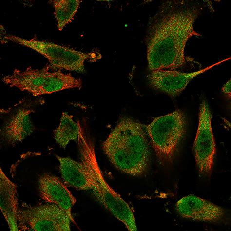 Subcellular - ELP1 - The Human Protein Atlas