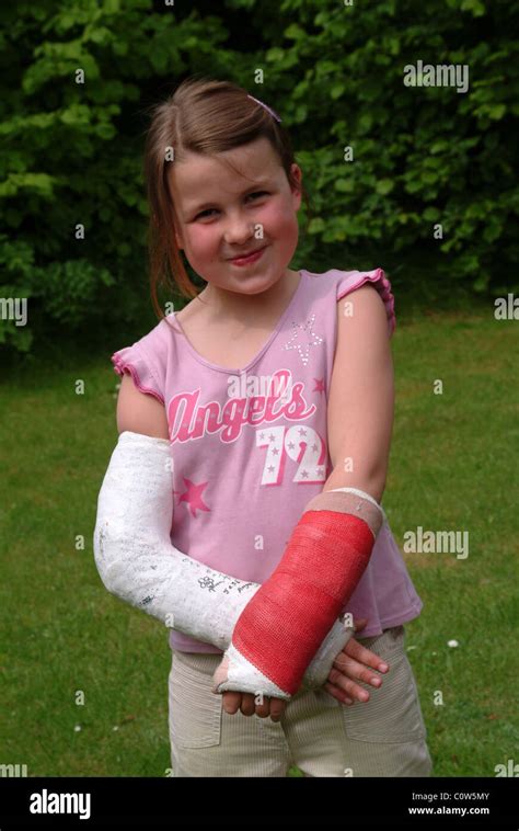 Just Cast Her Broken Arm