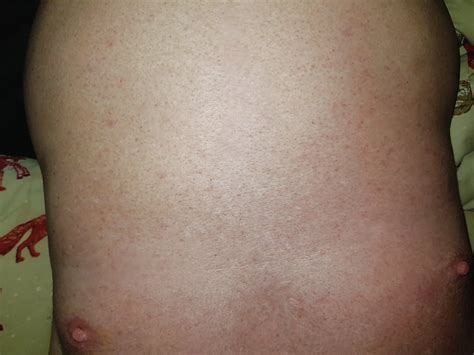 Smooth Body Nude Pics Xhamster