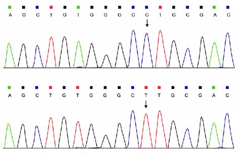 The Partial Dna Sequence Cc And Tt Genotypes Of Exon 4 Region In Ldlr Download Scientific