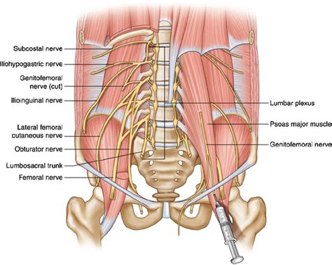 Lateral Femoral Cutaneous Nerve - Clinical Tree