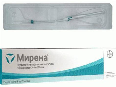 Внутриматочная спираль: виды, цены, как выбрать лучшую - мирена, юнона ...
