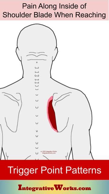 Shoulder Blade Pain Diagnosis Chart