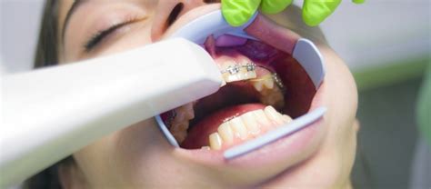 Виды мазей для десен: обзор наиболее эффективных парадонтических мазей