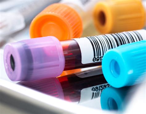 Cortisol blood test