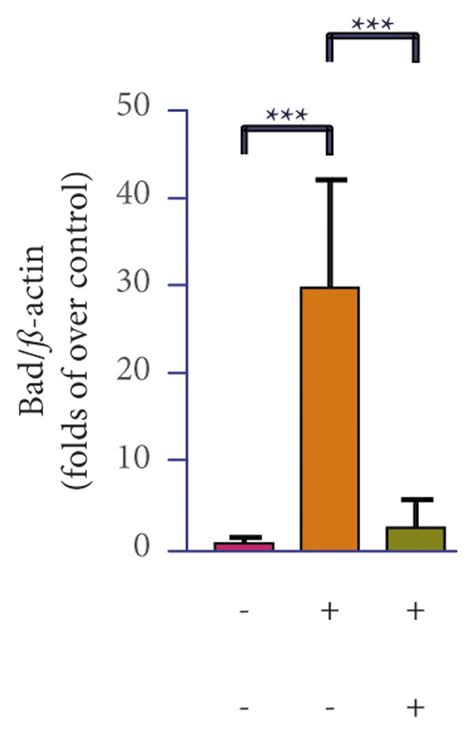 Jpyst Ameliorates Cddp Induced Renal Apoptosis Levels A Apoptosis Of